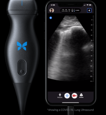 Butterfly IQ device